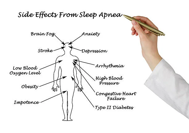 Diagram of health effects of untreated sleep apnea